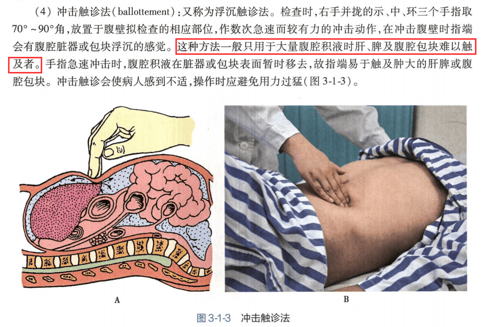 适用于大量腹腔积液时肝脾及腹腔包块难以触及者的触诊方法为